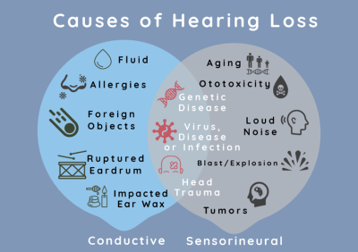 Causes of hearing loss.png